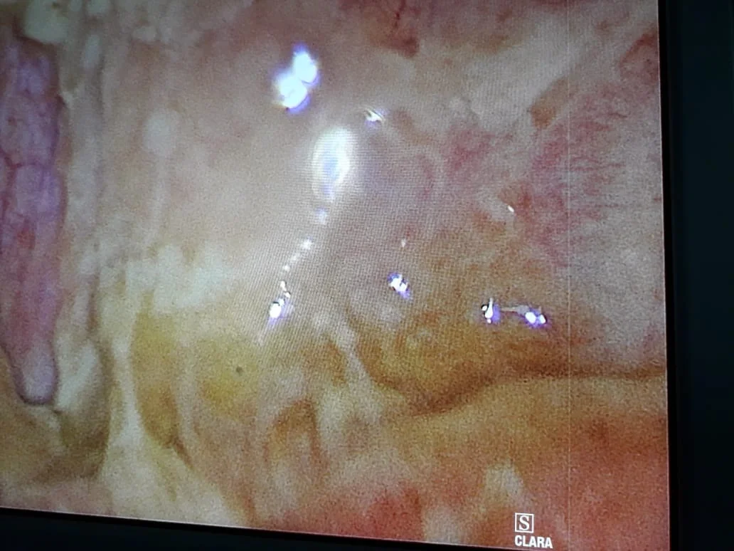 Surgery