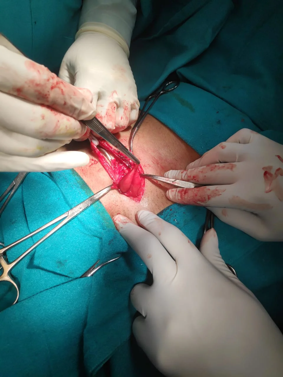 Surgery