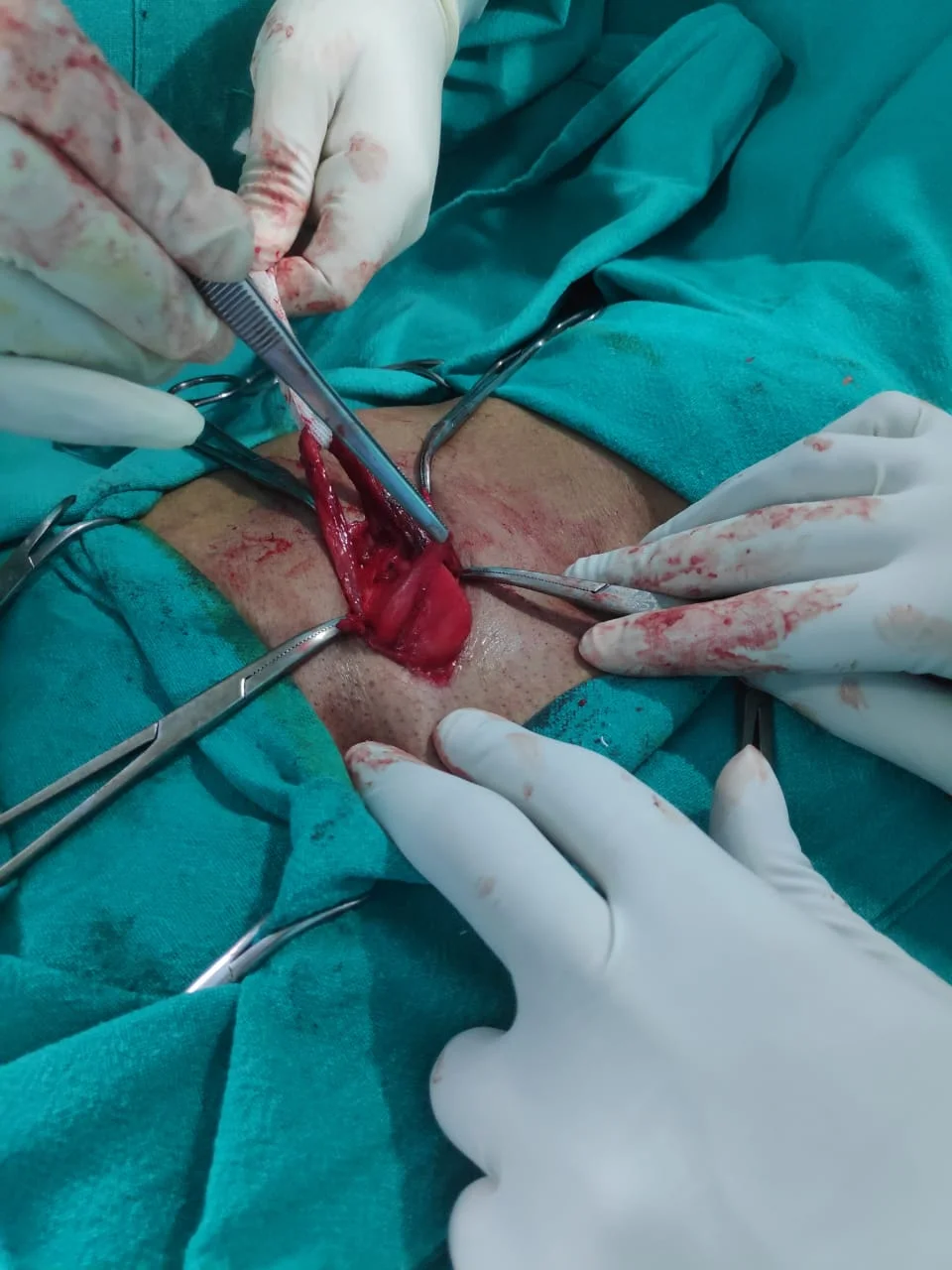 Surgery