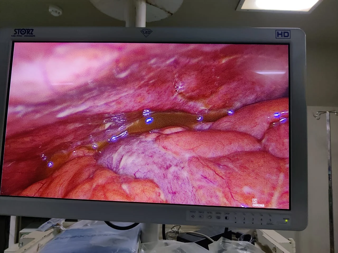 Surgery