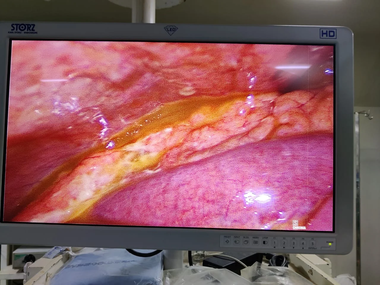 Surgery