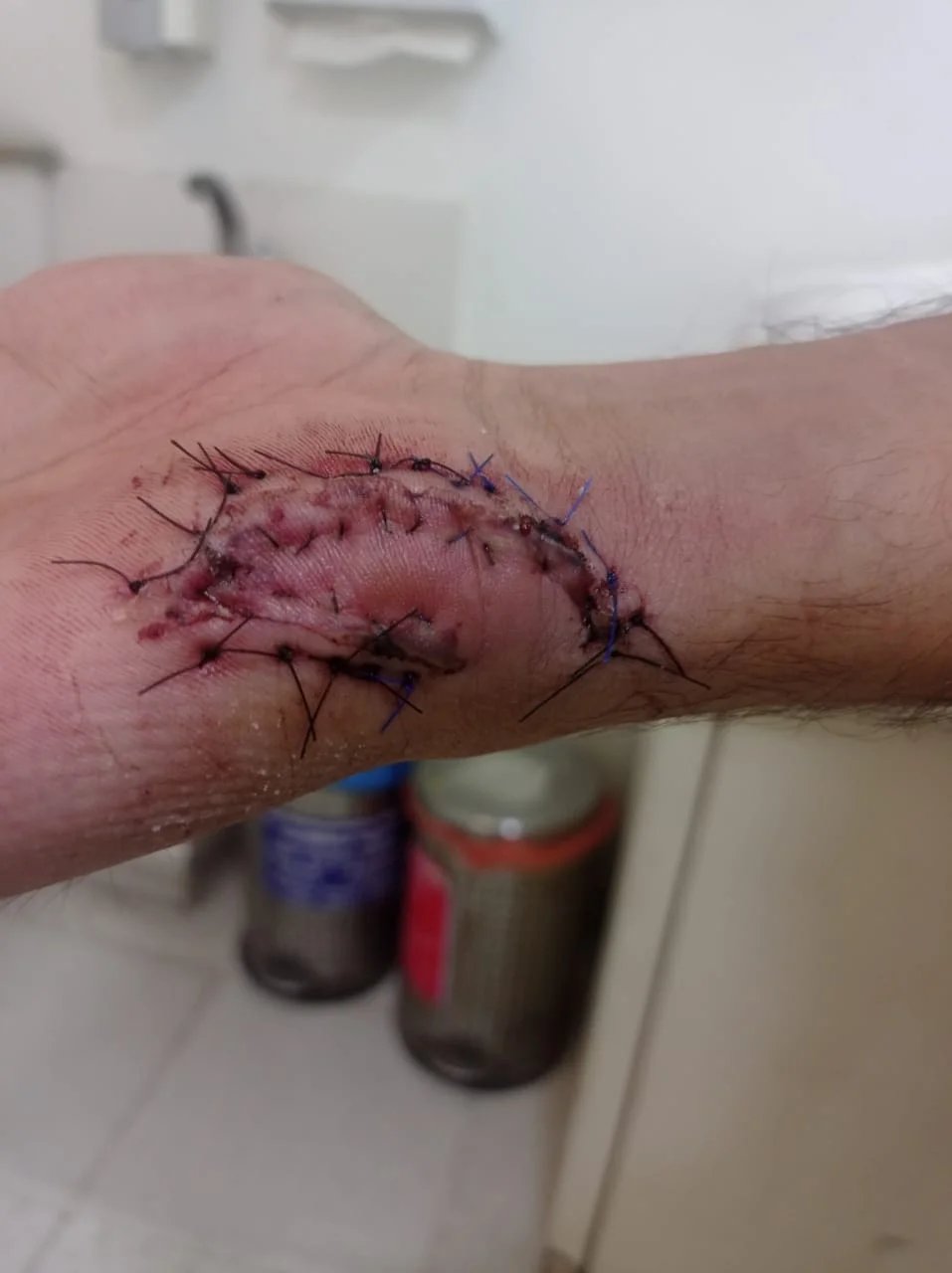 Surgery
