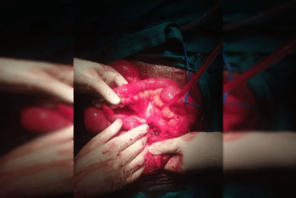 Surgery