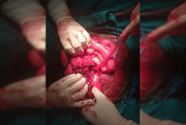 Surgery