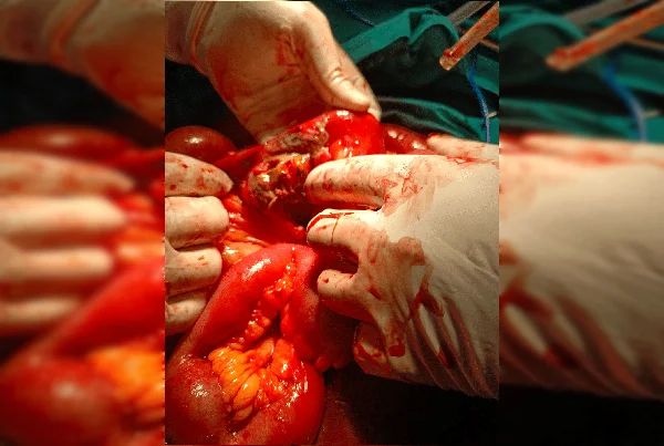 Surgery