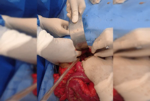 Surgery
